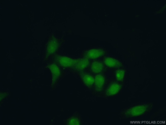 XRCC1 Antibody in Immunocytochemistry (ICC/IF)