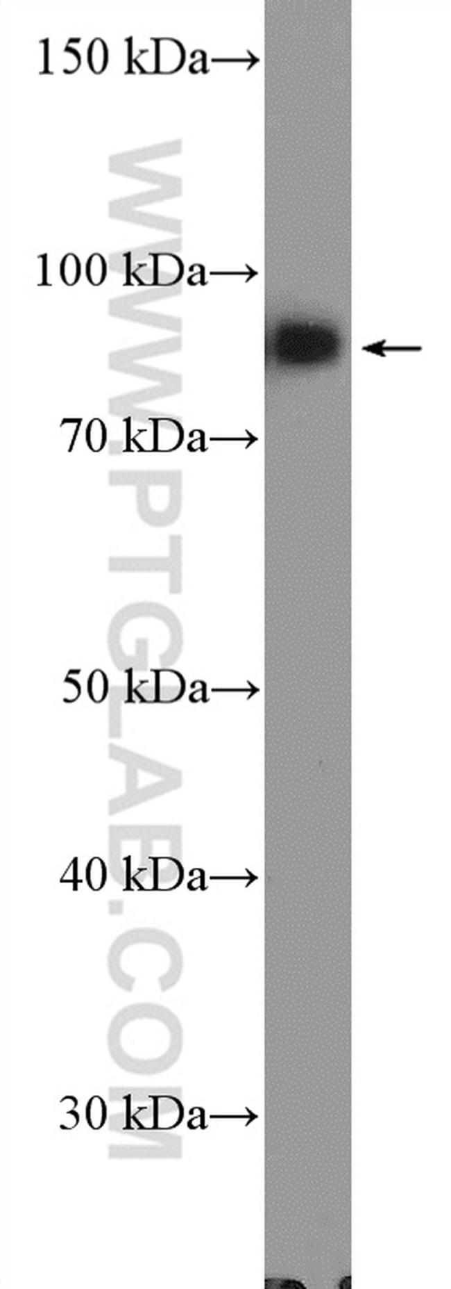 XRCC1 Antibody in Western Blot (WB)