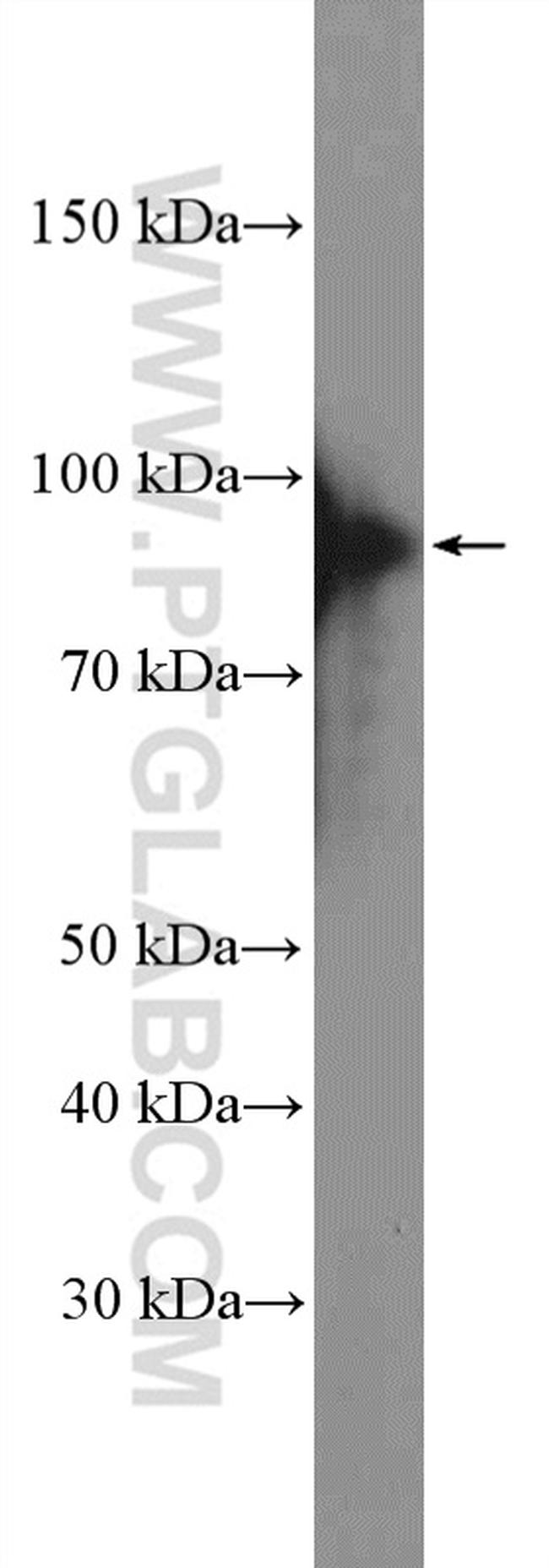 XRCC1 Antibody in Western Blot (WB)