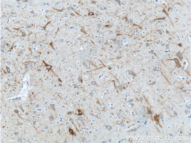 NF-H Antibody in Immunohistochemistry (Paraffin) (IHC (P))