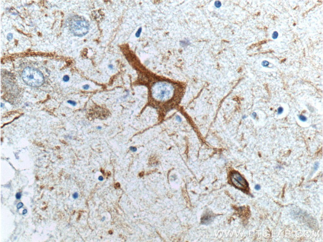 NF-H Antibody in Immunohistochemistry (Paraffin) (IHC (P))