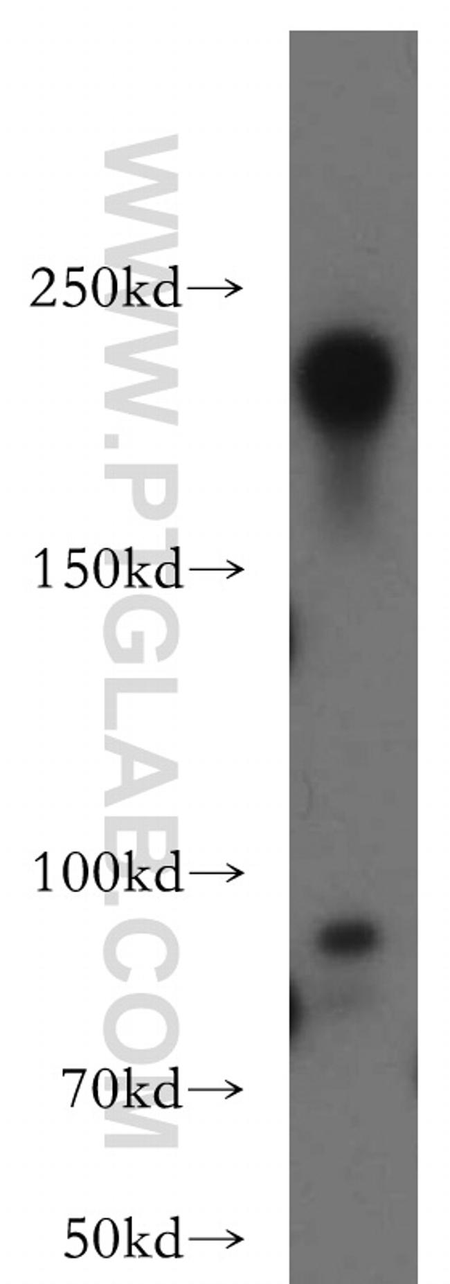 NF-H Antibody in Western Blot (WB)