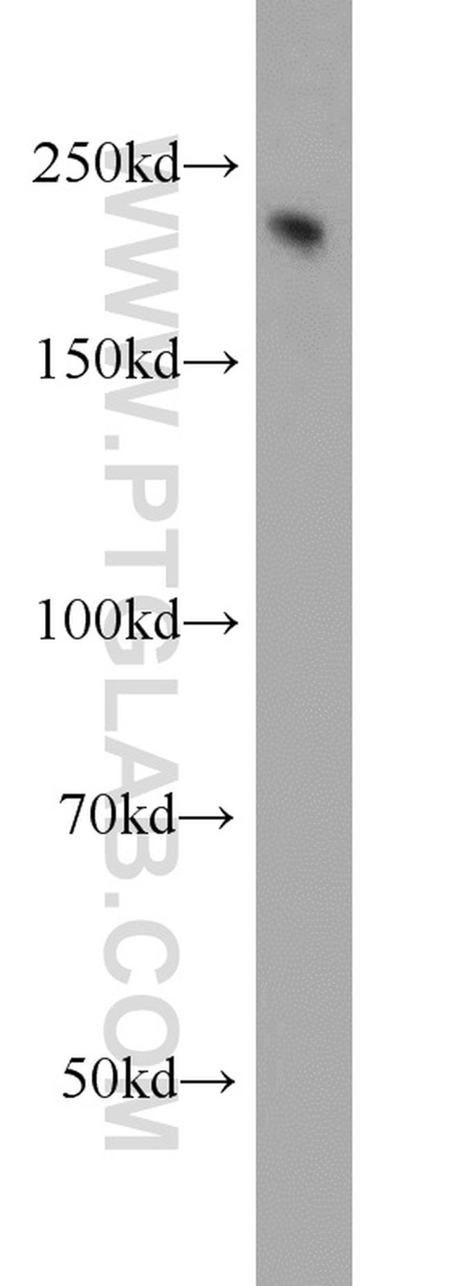 NF-H Antibody in Western Blot (WB)