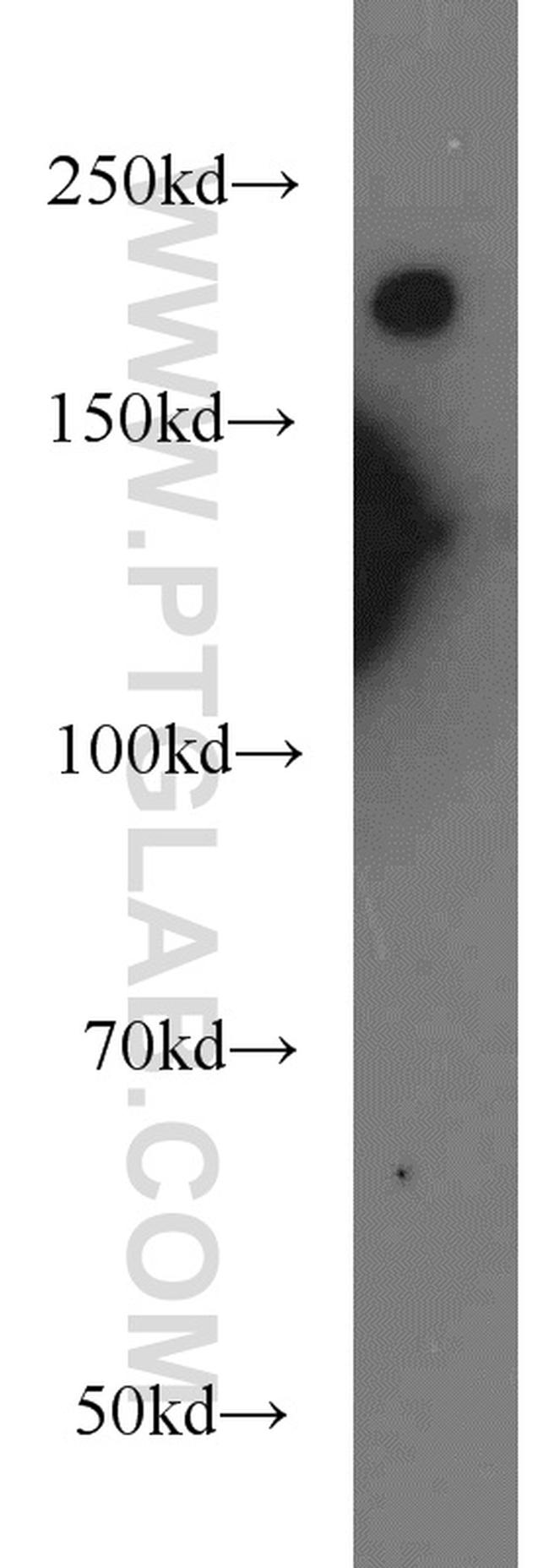 NF-H Antibody in Western Blot (WB)