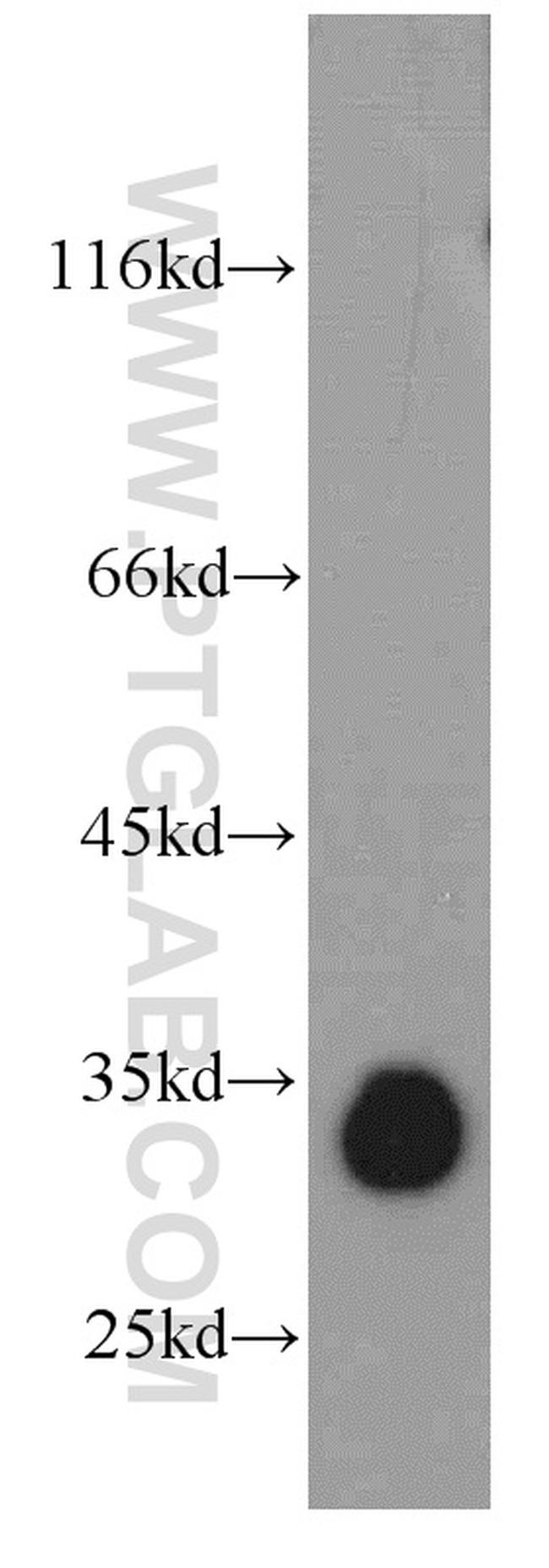 KIAA0513 Antibody in Western Blot (WB)