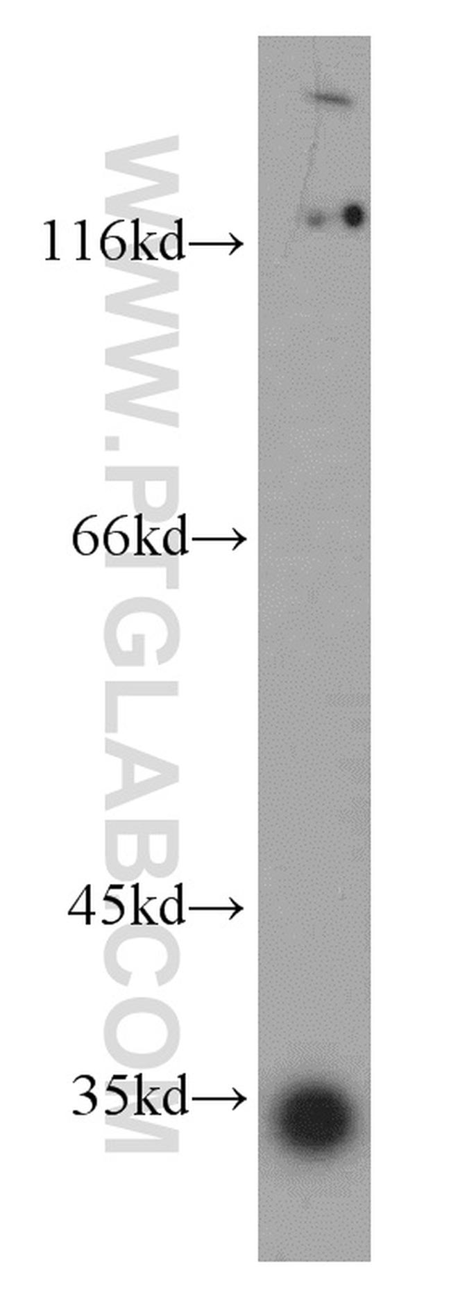 KIAA0513 Antibody in Western Blot (WB)