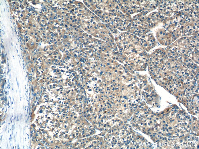 F9 Antibody in Immunohistochemistry (Paraffin) (IHC (P))