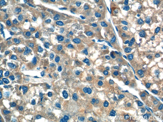 F9 Antibody in Immunohistochemistry (Paraffin) (IHC (P))