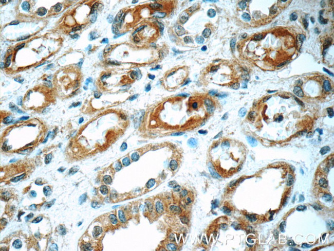 IFIT1L Antibody in Immunohistochemistry (Paraffin) (IHC (P))