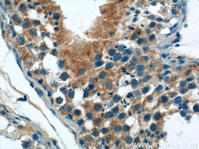 IFIT1L Antibody in Immunohistochemistry (Paraffin) (IHC (P))