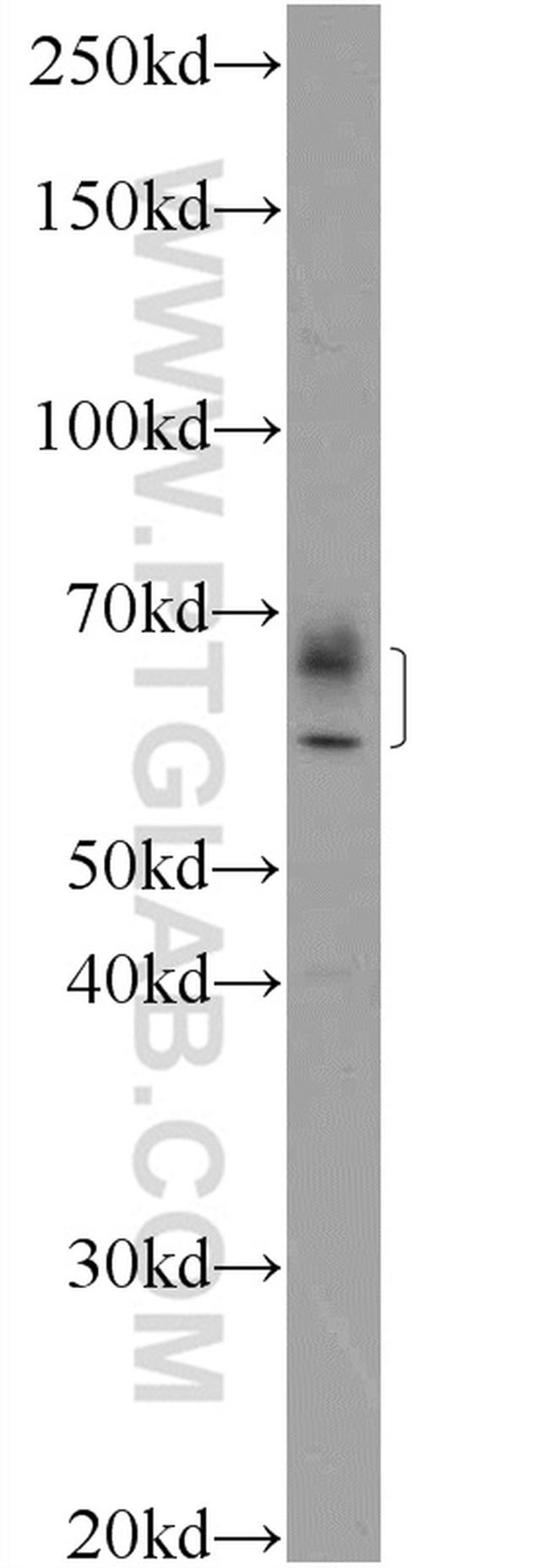 IFIT1L Antibody in Western Blot (WB)