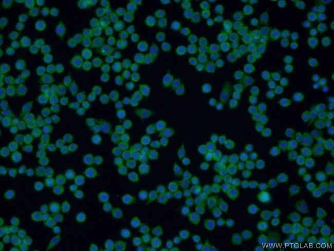 IFIT1L Antibody in Immunocytochemistry (ICC/IF)