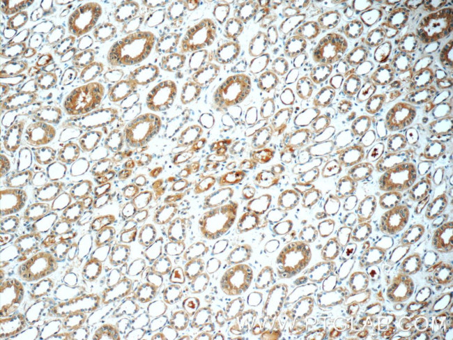 IFIT1L Antibody in Immunohistochemistry (Paraffin) (IHC (P))