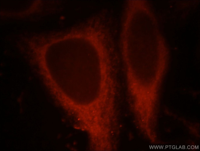 CHIA Antibody in Immunocytochemistry (ICC/IF)