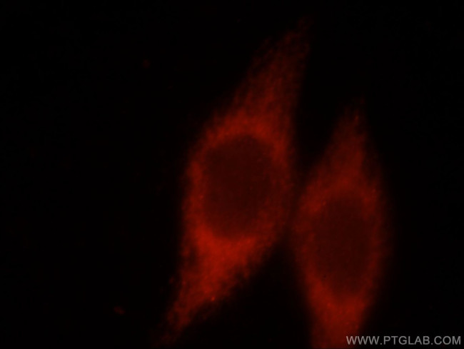 CHIA Antibody in Immunocytochemistry (ICC/IF)