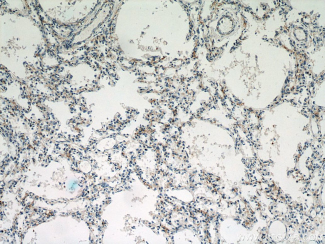 CHIA Antibody in Immunohistochemistry (Paraffin) (IHC (P))