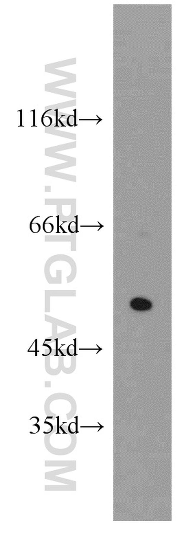 CHIA Antibody in Western Blot (WB)