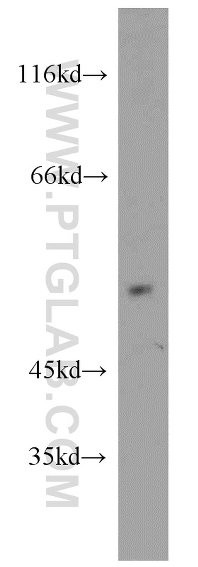 CHIA Antibody in Western Blot (WB)