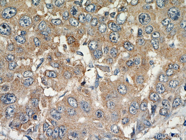 MAGEC3 Antibody in Immunohistochemistry (Paraffin) (IHC (P))