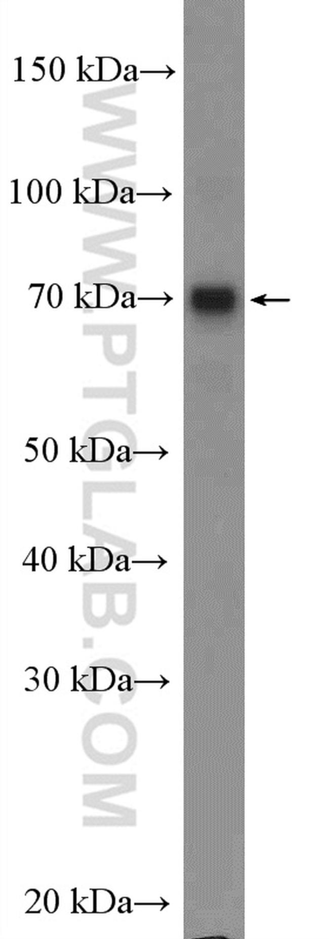 MAGEC3 Antibody in Western Blot (WB)