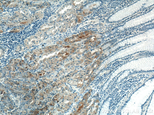 VANGL2 Antibody in Immunohistochemistry (Paraffin) (IHC (P))