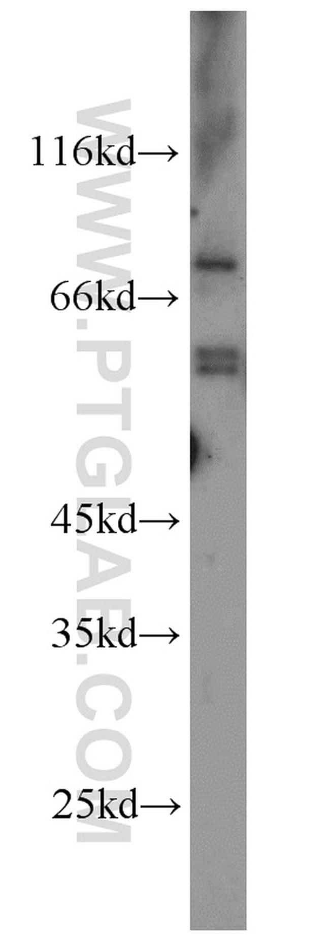 VANGL2 Antibody in Western Blot (WB)