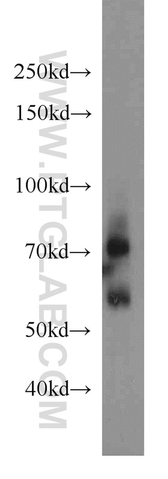 VANGL2 Antibody in Western Blot (WB)