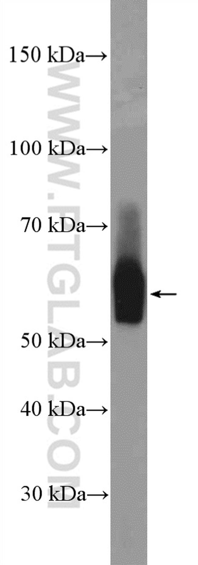 VANGL2 Antibody in Western Blot (WB)