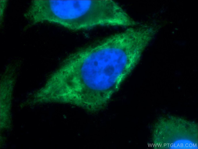 TXNDC16 Antibody in Immunocytochemistry (ICC/IF)