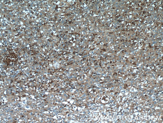 TXNDC16 Antibody in Immunohistochemistry (Paraffin) (IHC (P))