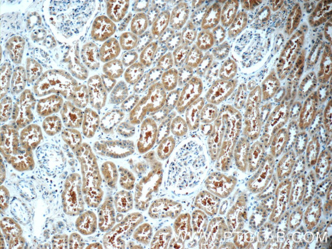 TXNDC16 Antibody in Immunohistochemistry (Paraffin) (IHC (P))