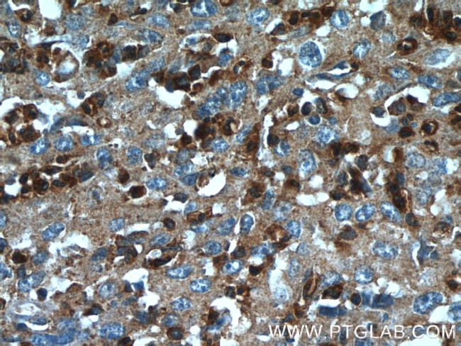 TXNDC16 Antibody in Immunohistochemistry (Paraffin) (IHC (P))