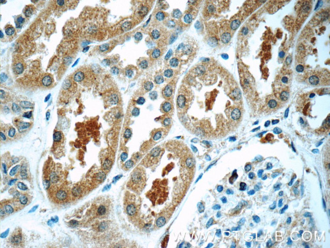 TXNDC16 Antibody in Immunohistochemistry (Paraffin) (IHC (P))