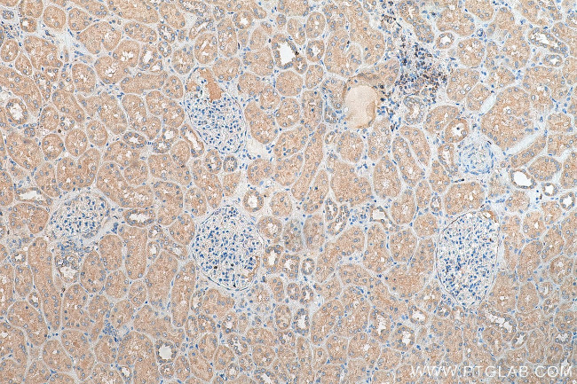 TXNDC16 Antibody in Immunohistochemistry (Paraffin) (IHC (P))