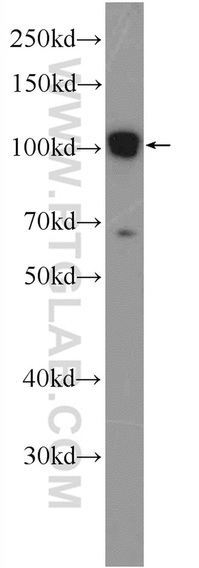 TXNDC16 Antibody in Western Blot (WB)