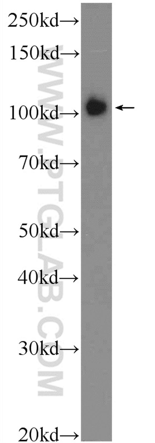 TXNDC16 Antibody in Western Blot (WB)