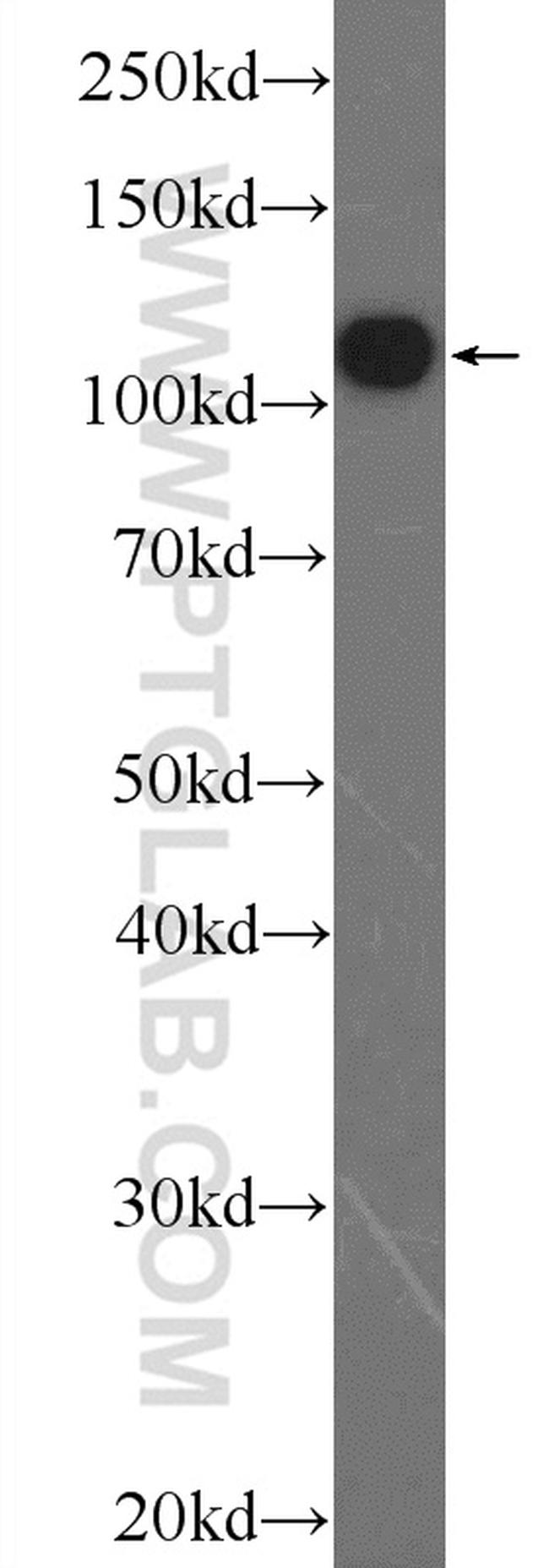 TXNDC16 Antibody in Western Blot (WB)