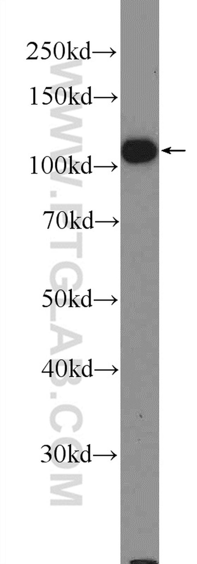 TXNDC16 Antibody in Western Blot (WB)