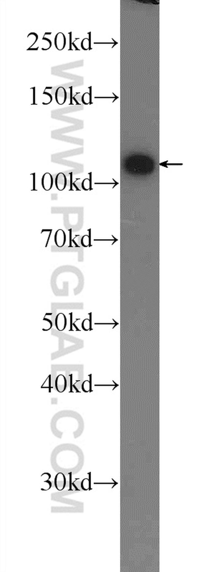 TXNDC16 Antibody in Western Blot (WB)