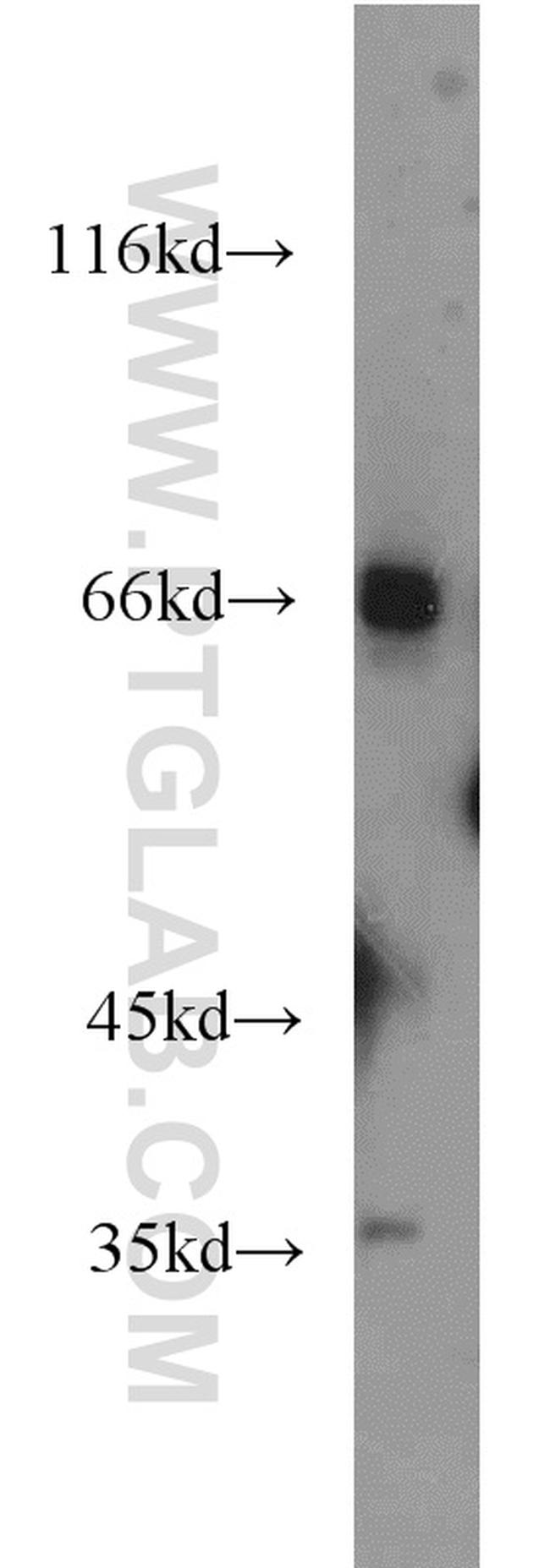 C19orf44 Antibody in Western Blot (WB)