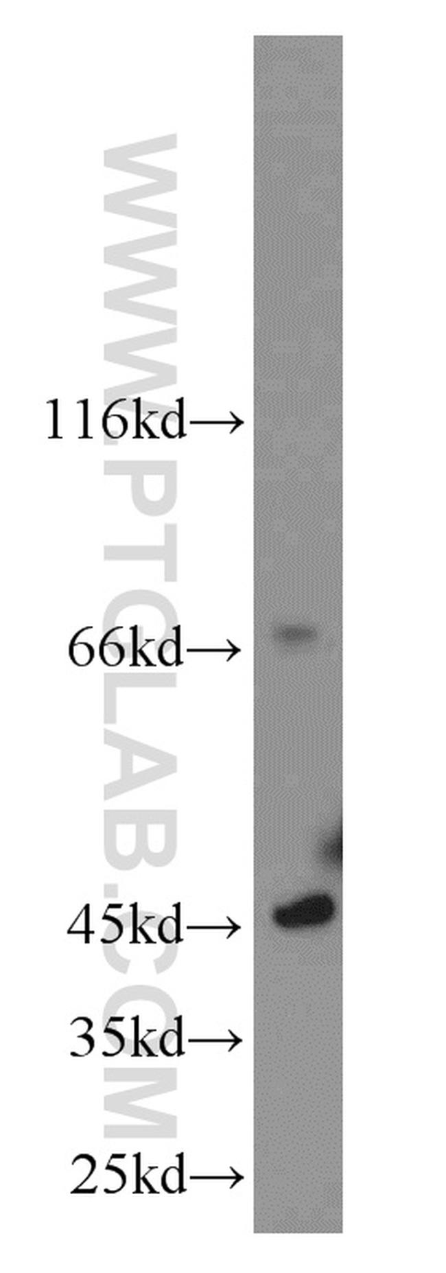 C19orf44 Antibody in Western Blot (WB)