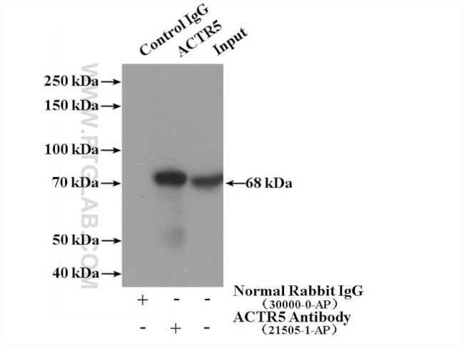 Arp5/ACTR5 Antibody in Immunoprecipitation (IP)