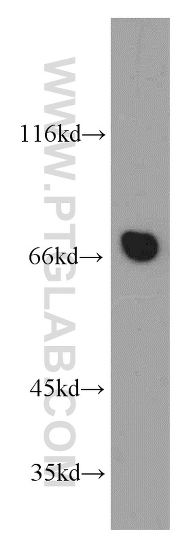 Arp5/ACTR5 Antibody in Western Blot (WB)