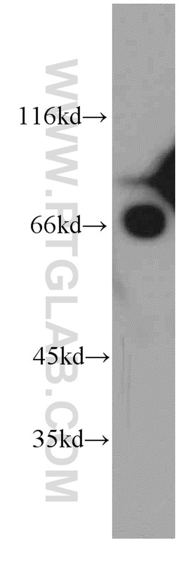 Arp5/ACTR5 Antibody in Western Blot (WB)