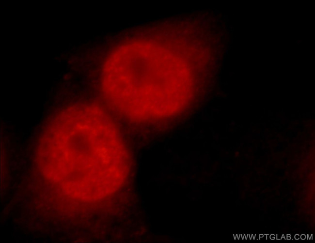 C1orf106 Antibody in Immunocytochemistry (ICC/IF)