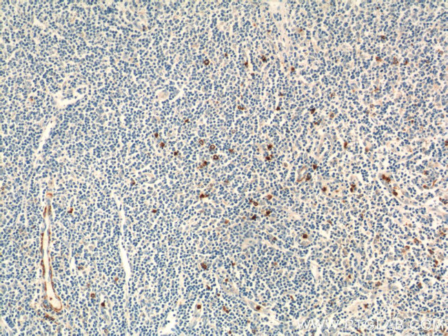 KLRF1 Antibody in Immunohistochemistry (Paraffin) (IHC (P))