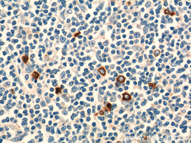 KLRF1 Antibody in Immunohistochemistry (Paraffin) (IHC (P))