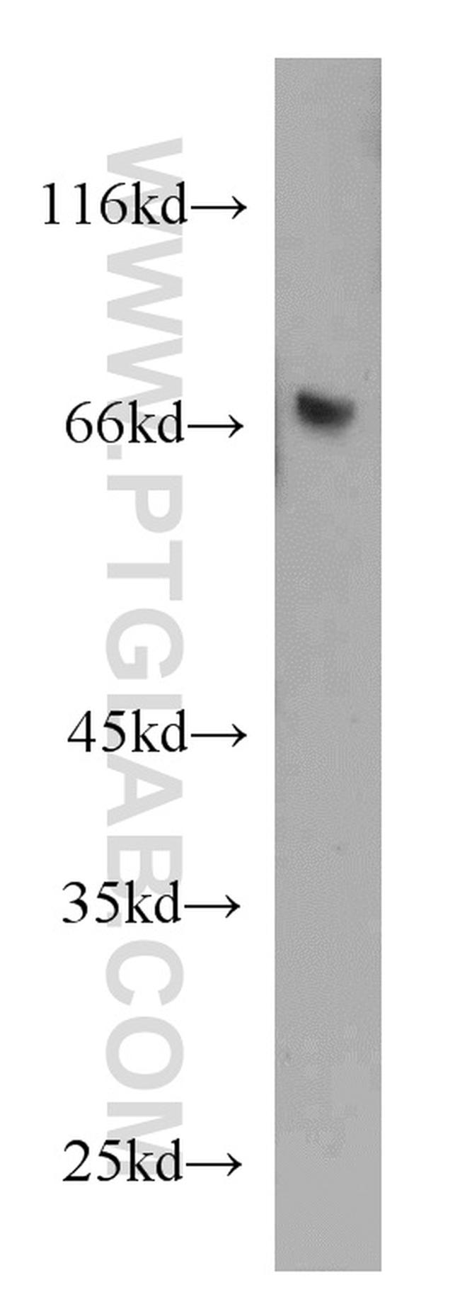 KLRF1 Antibody in Western Blot (WB)