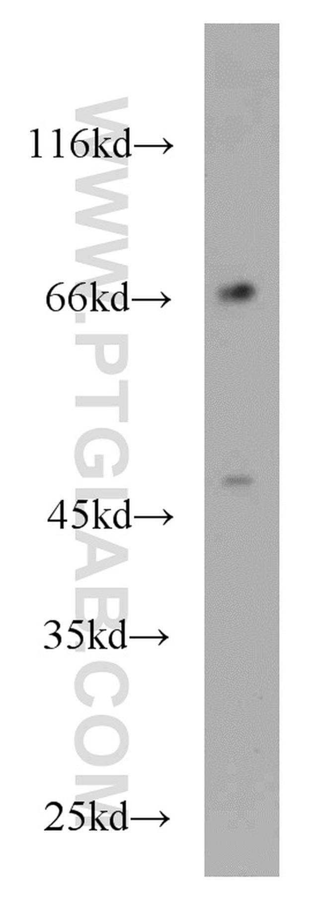 KLRF1 Antibody in Western Blot (WB)