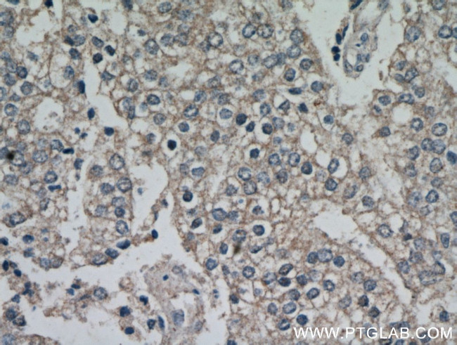 FZD5 Antibody in Immunohistochemistry (Paraffin) (IHC (P))